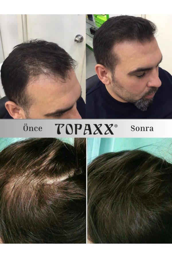 رنگ مو اورجینال برند Topaxx کد 819400669 - Image 6