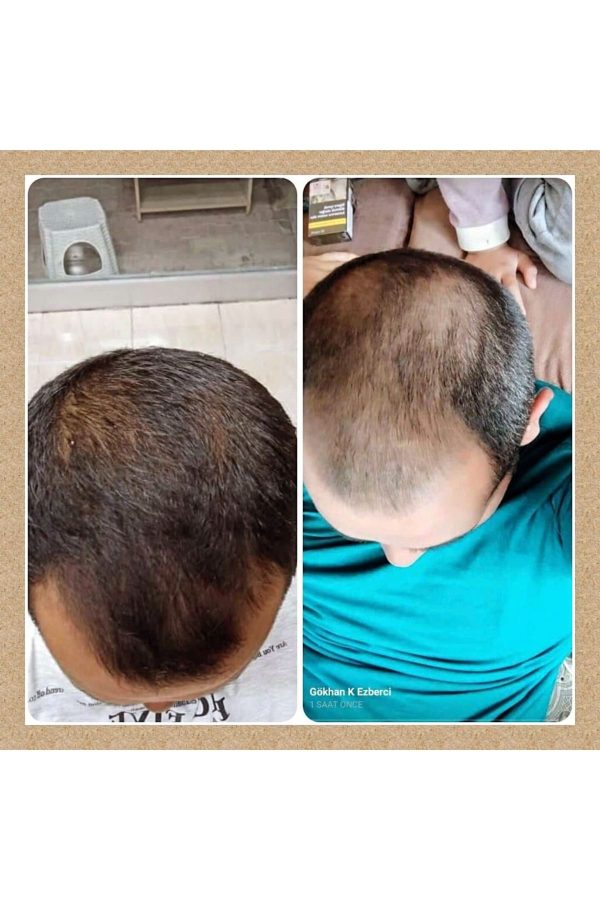 ست مراقبت از مو اورجینال برند Xena silver مدل Silver Hair Serum Set کد 807190235 - Image 2