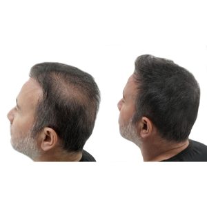 رنگ مو اورجینال برند Wollen kozmetik مدل Hair Thickening Root Dye Set کد 373079011