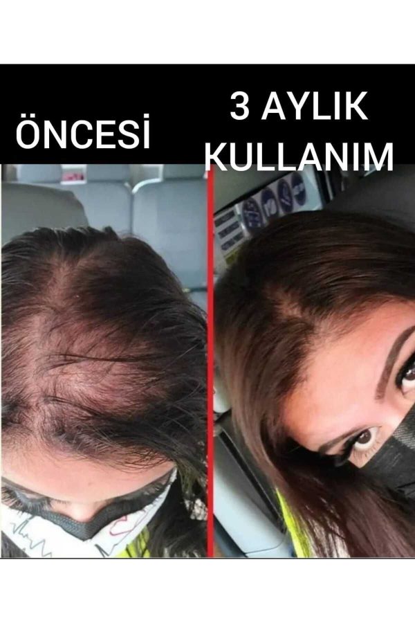ست مراقبت از مو اورجینال برند Dermanew hair کد 127396088 - Image 4