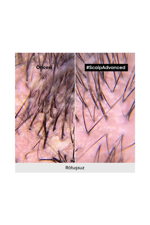 شامپو اورجینال برند L oreal professionnel کد 816705543 - Image 5