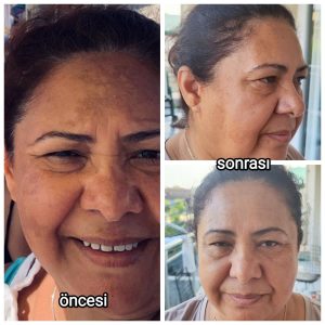 کرم صورت اورجینال برند Eucerin کد 754011118