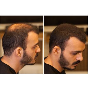 رنگ مو اورجینال برند Fixdeep کد 846778215