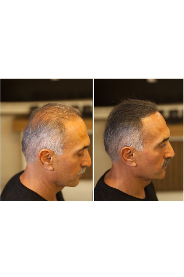 رنگ مو اورجینال برند Fixplant کد 846877649 - Image 2